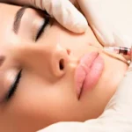 Botox Vila Andrade Morumbi - Botox Perto de Mim