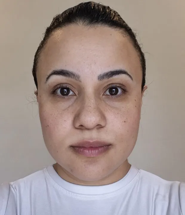 Realize o sonho de ter uma pele mais jovem e radiante! A Clínica Soul Musa oferece o tratamento de rejuvenescimento facial indolor, ideal para quem busca resultados eficazes e naturais. Livre-se das marcas do tempo e recupere sua autoestima. Agende uma visita em nossa clínica no Morumbi e descubra o segredo para uma aparência renovada.