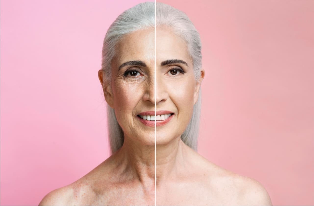 Bioestimulador de Colágeno na Soul Musa: Rejuvenesça sua Beleza Natural