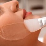 Peeling Químico? Descubra o Controle Natural da Acne e Oleosidade com o Peeling de Quartzo ADCOS!