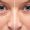 Blefaroplastia Sem Corte: Rejuvenesça Seu Olhar com o Jato de Plasma e Conforto Absoluto!