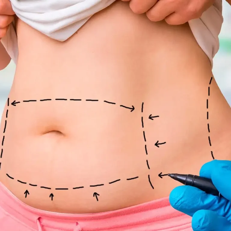 Como Perder Gordura Localizada: Conquiste o Corpo dos Seus Sonhos Sem Cirurgia e com Resultados Visíveis!