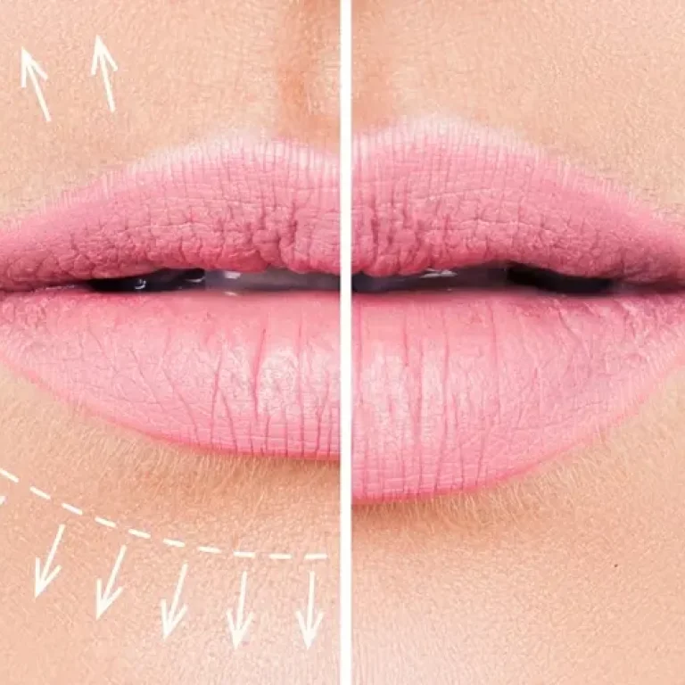 Preenchimento Labial Perto de Mim