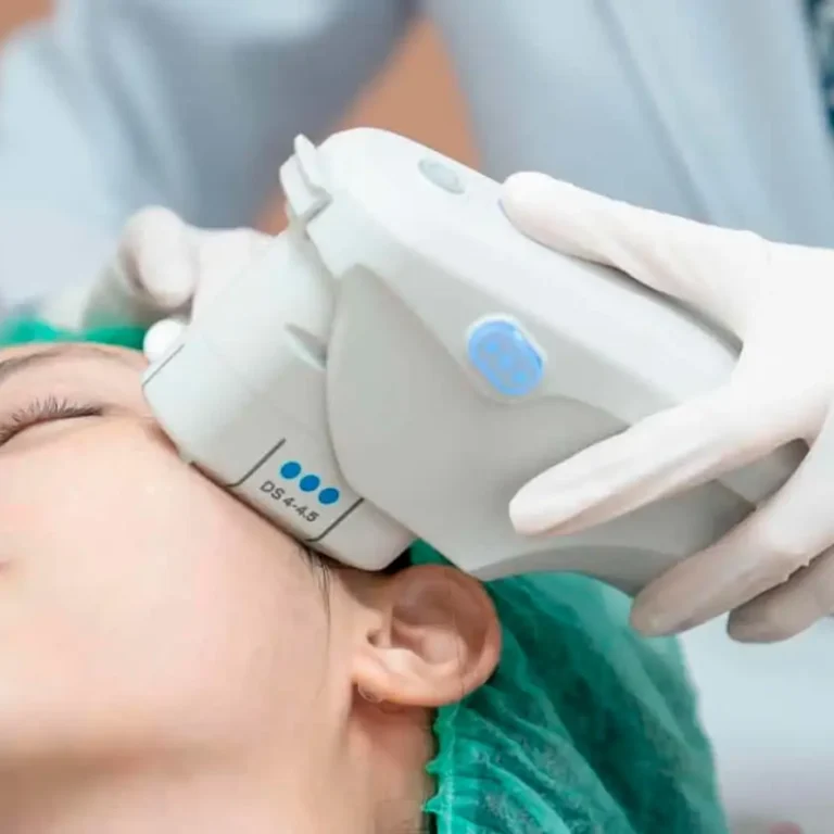 Ultrassom Microfocado 4D na Soul Musa: Lifting e Rejuvenescimento Sem Cortes